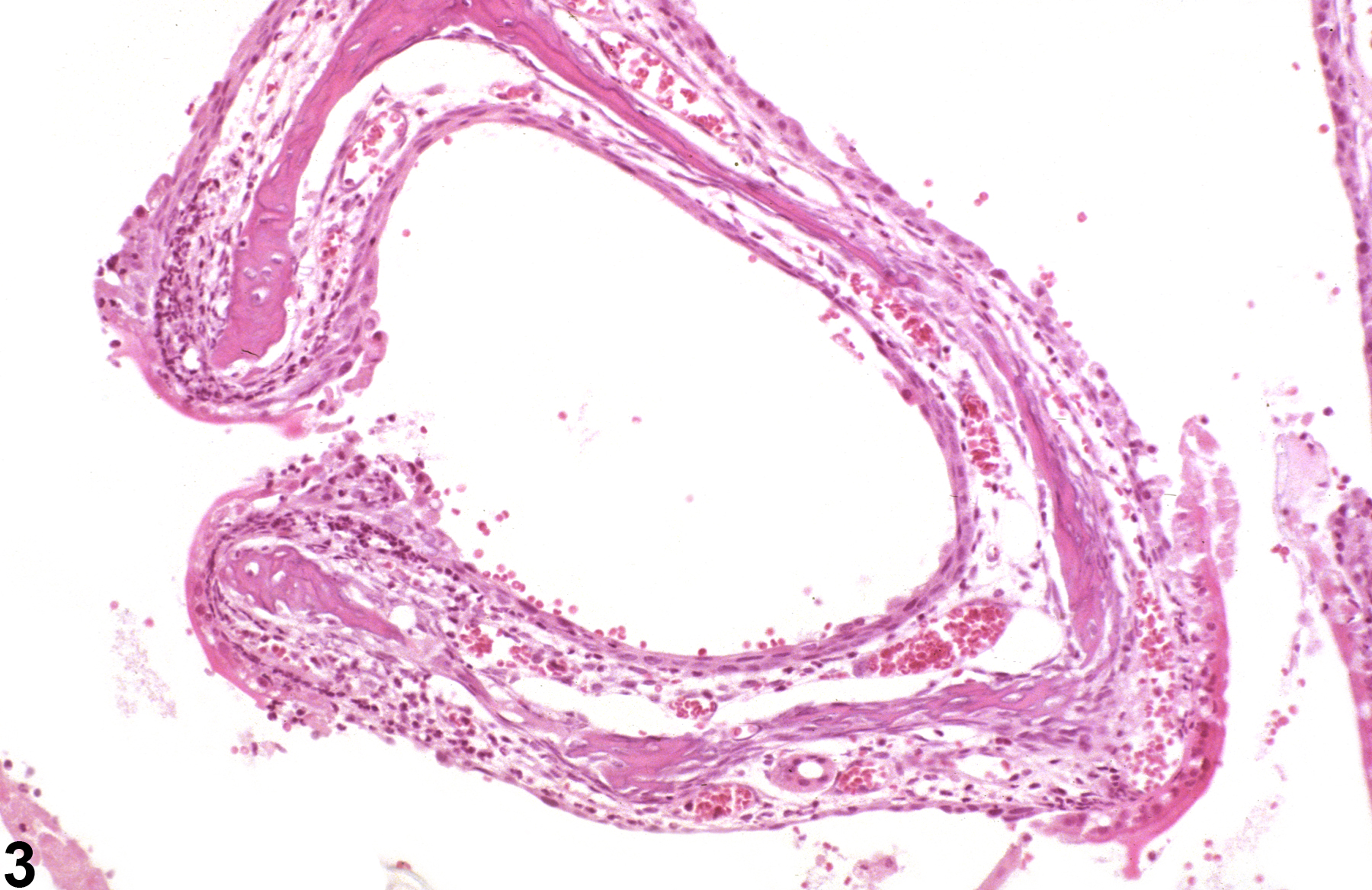 Image of necrosis in the nose, transitional epithelium from a  B6C3F1/N mouse in a subchronic study