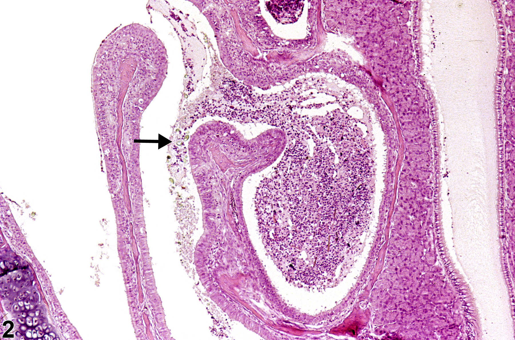 Image of foreign body in the nose from a female B6C3F1/N mouse in a subchronic study