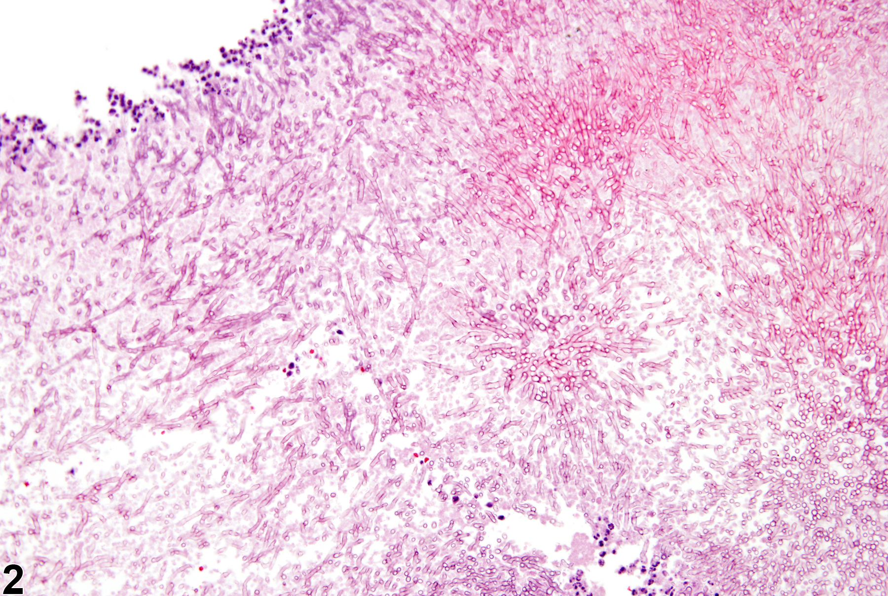 Image of fungus in the nose from a male F344/N rat in a chronic study