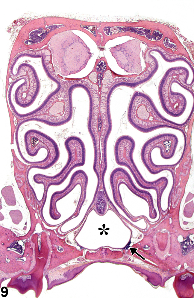 Image of normal nasal cavity (level III) in the nose from a male B6C3F1/N mouse in a subchronic study