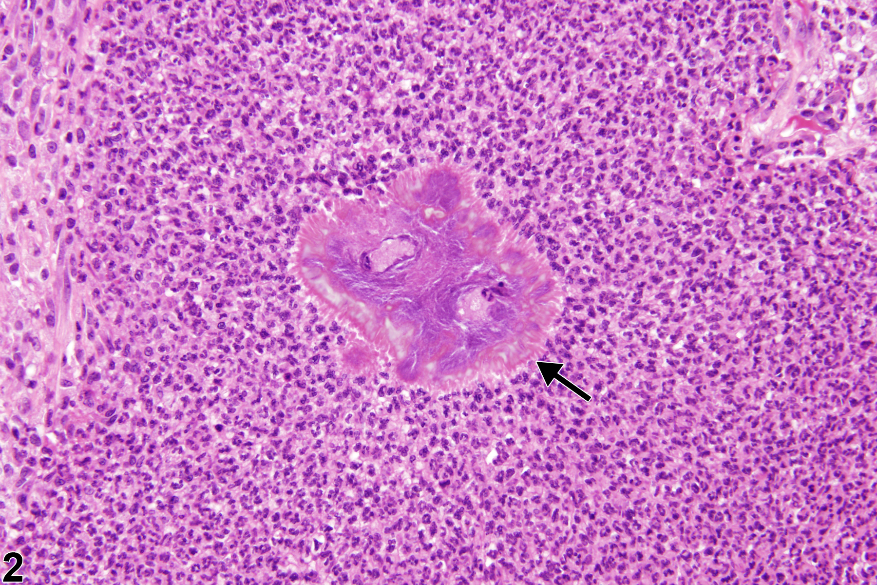 Image of inflammation in the nose, respiratory epithelium from a male F344/N rat in a chronic study