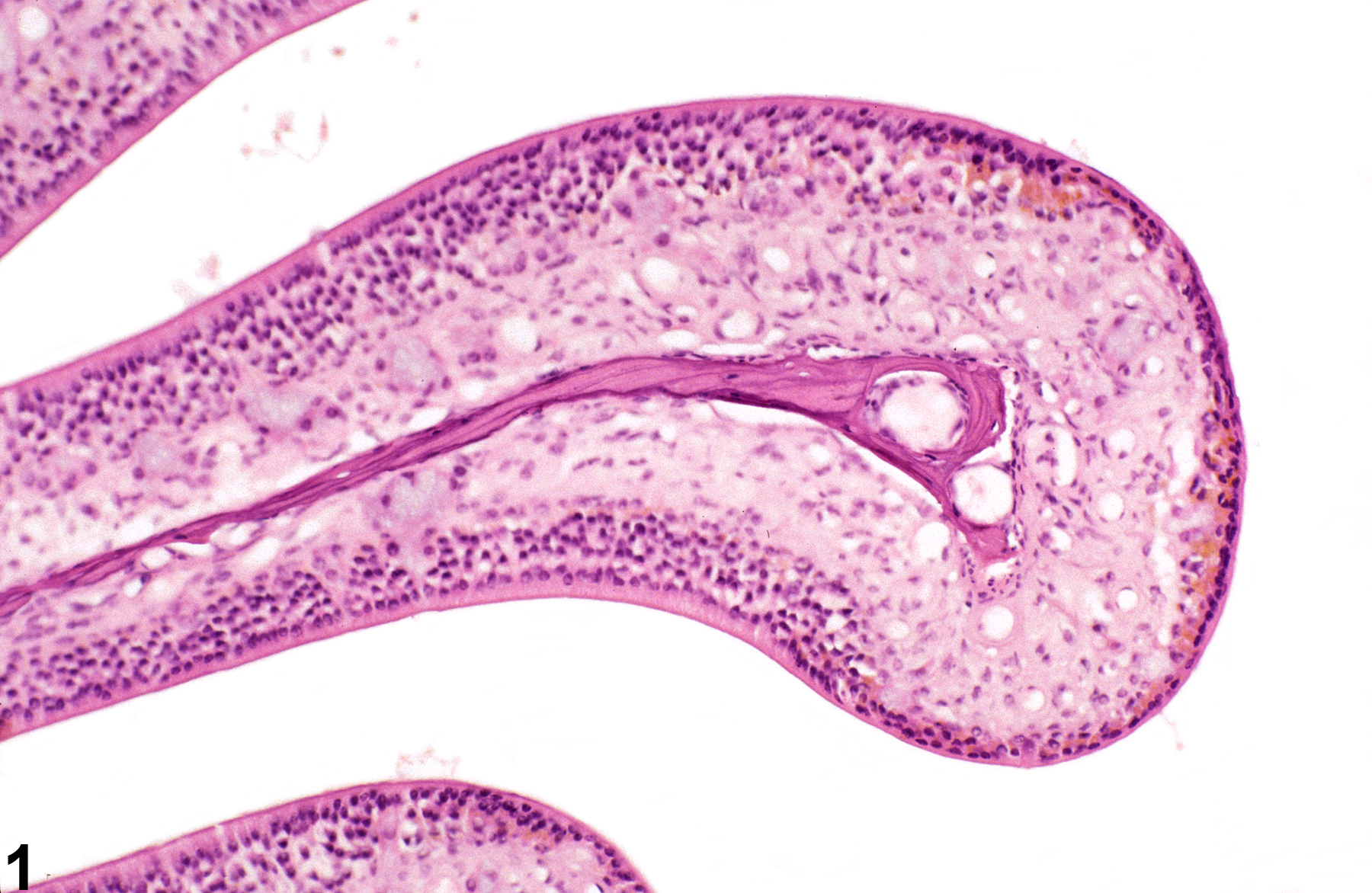Image of atrophy in the nose, olfactory epithelium from a female B6C3F1/N mouse in a chronic study