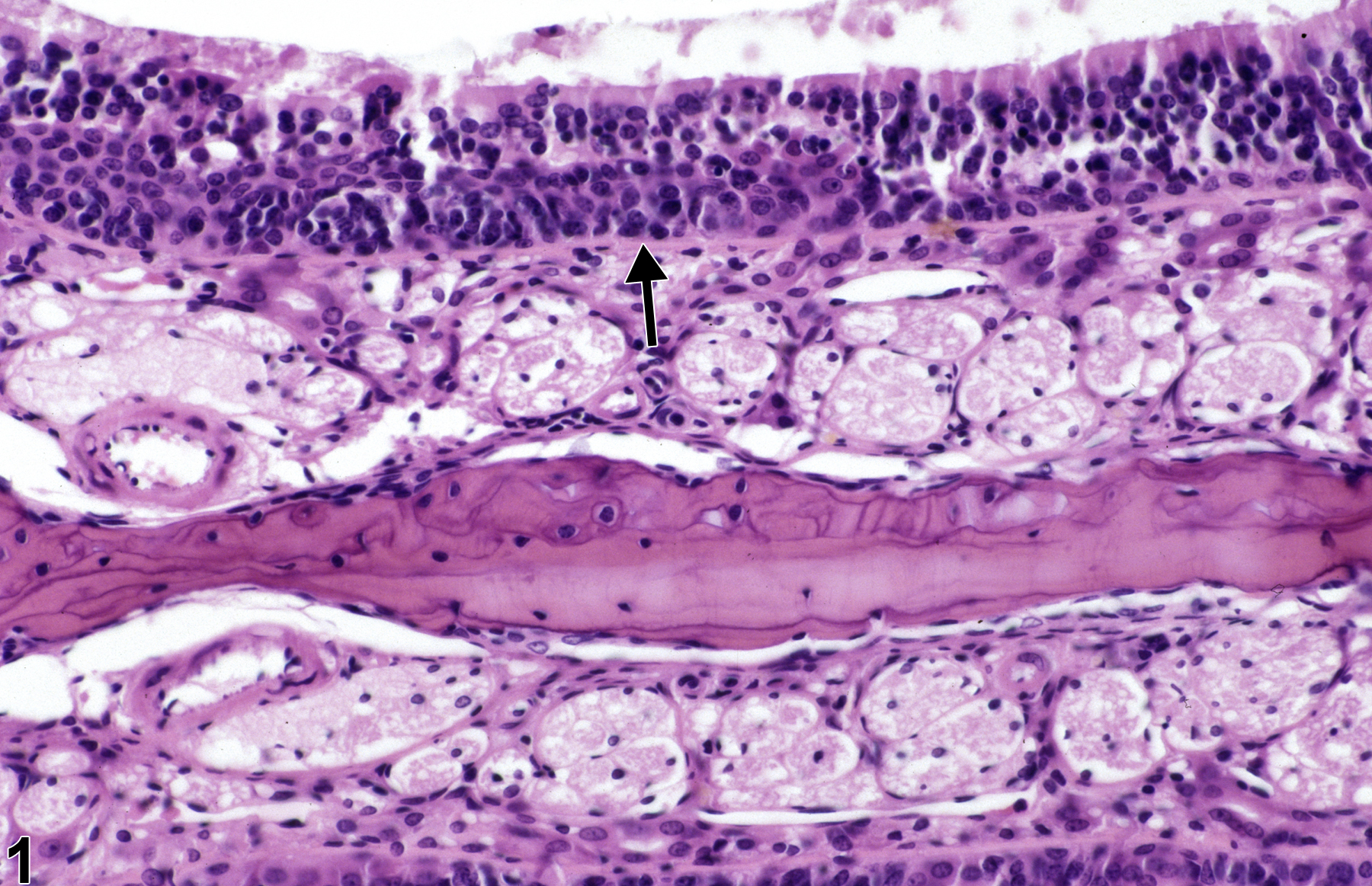 Image of hyperplasia, basal cell in the nose, olfactory epithelium from a male F344/N rat in a subchronic study