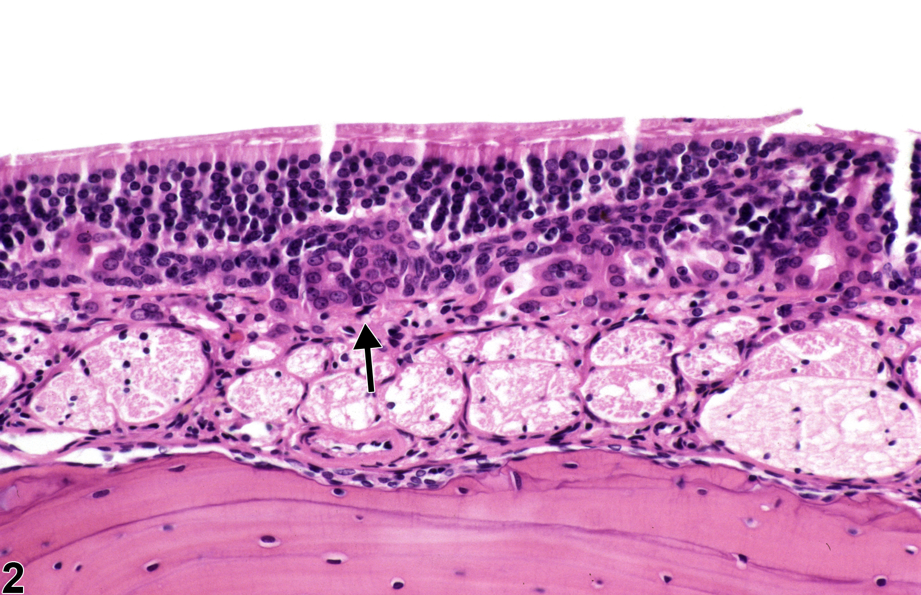 Image of hyperplasia, basal cell in the nose, olfactory epithelium from a male F344/N rat in a subchronic study