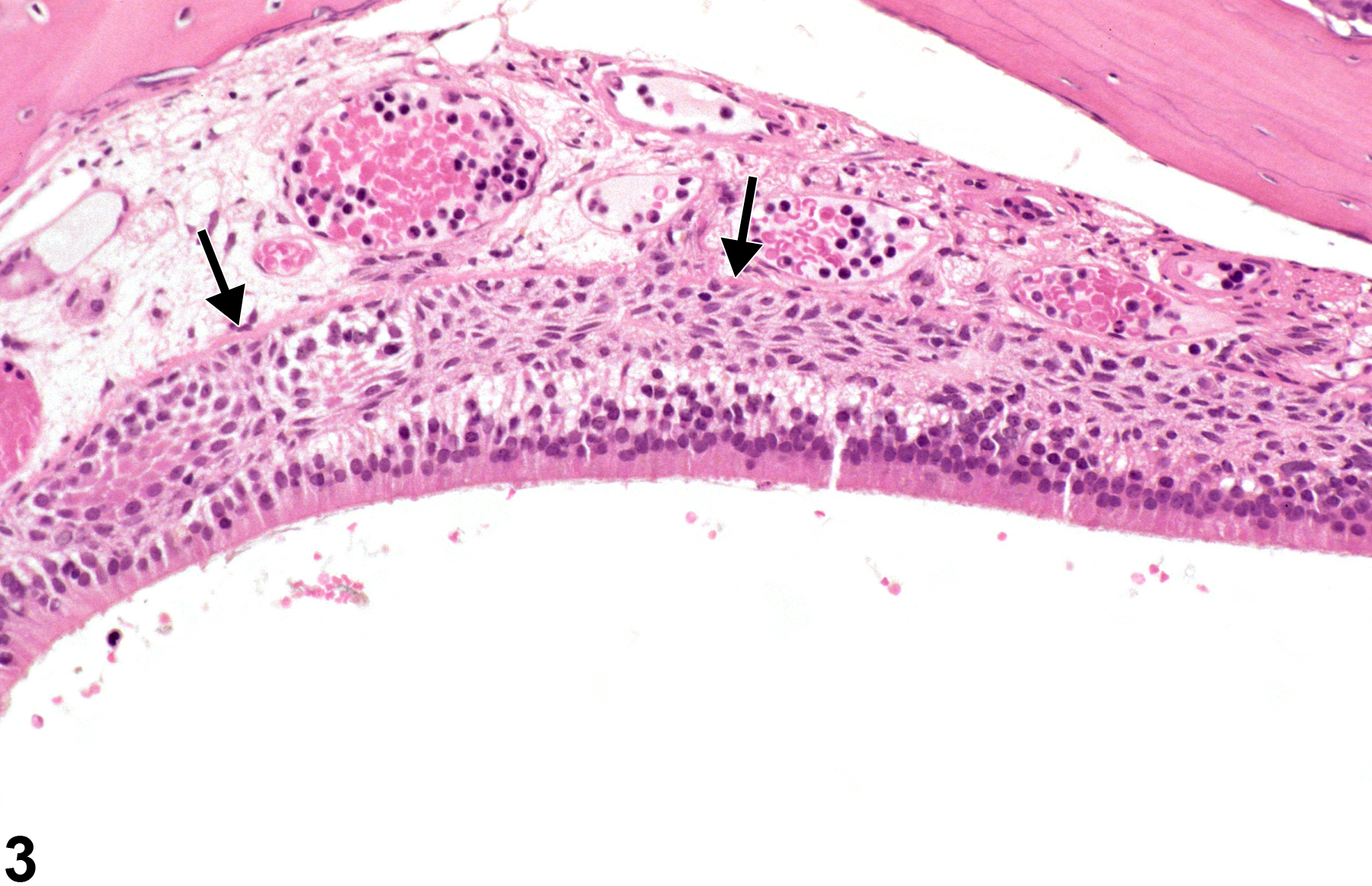 Image of hyperplasia, basal cell in the nose, olfactory epithelium from a female F344/N rat in a chronic study