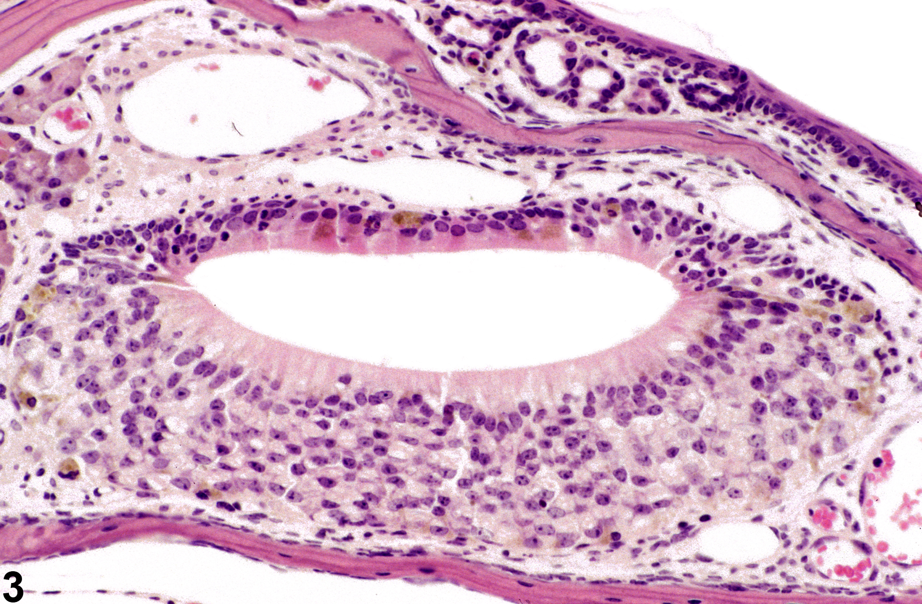 Image of pigment in the nose, vomeronasal organ from a female B6C3F1/N mouse in a subchronic study