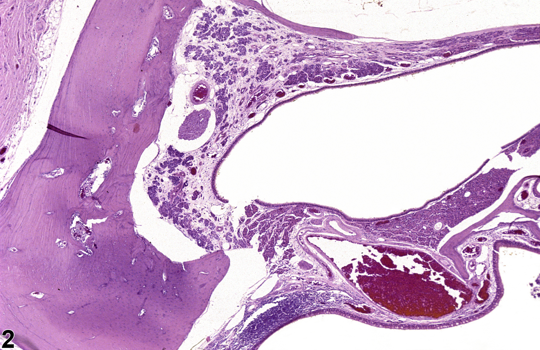 Image of degeneration in the nose, Steno's glands from a male F344/N rat in a chronic study