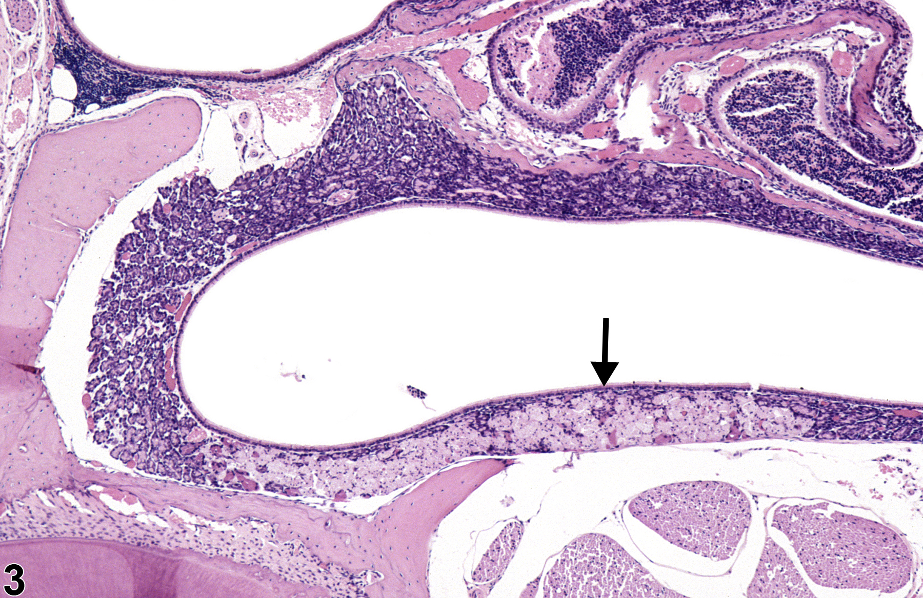 Image of degeneration in the nose, Steno's glands from a male B6C3F1/N mouse in a subchronic study