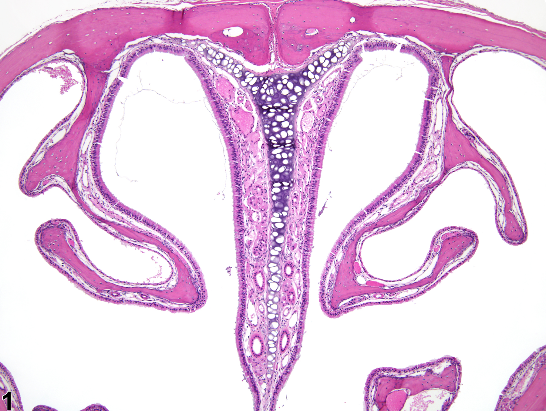 Image of atrophy in the nose, turbinate from a male B6C3F1/N mouse in a subchronic study