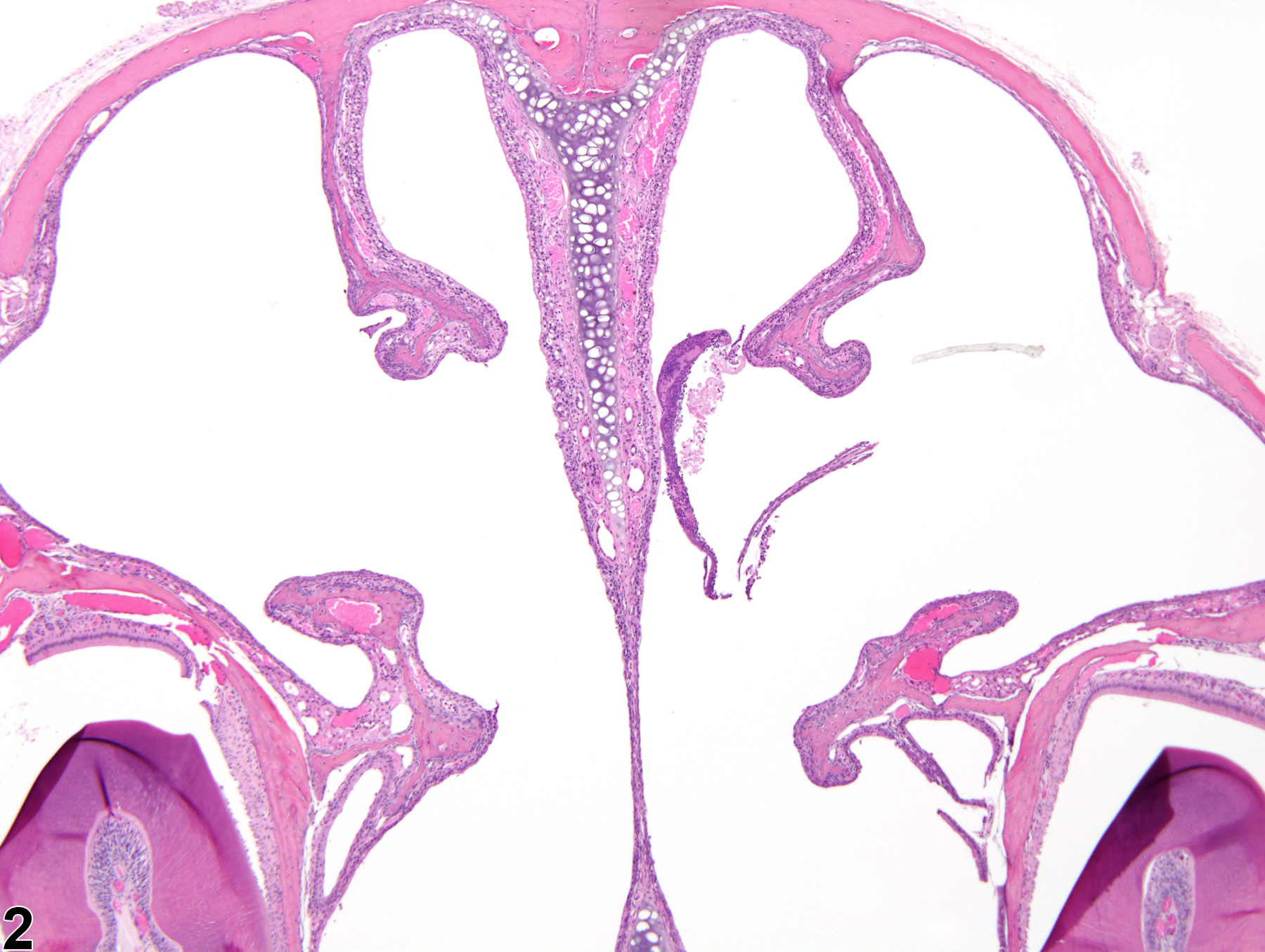 Image of atrophy in the nose, turbinate from a male B6C3F1/N mouse in a subchronic study