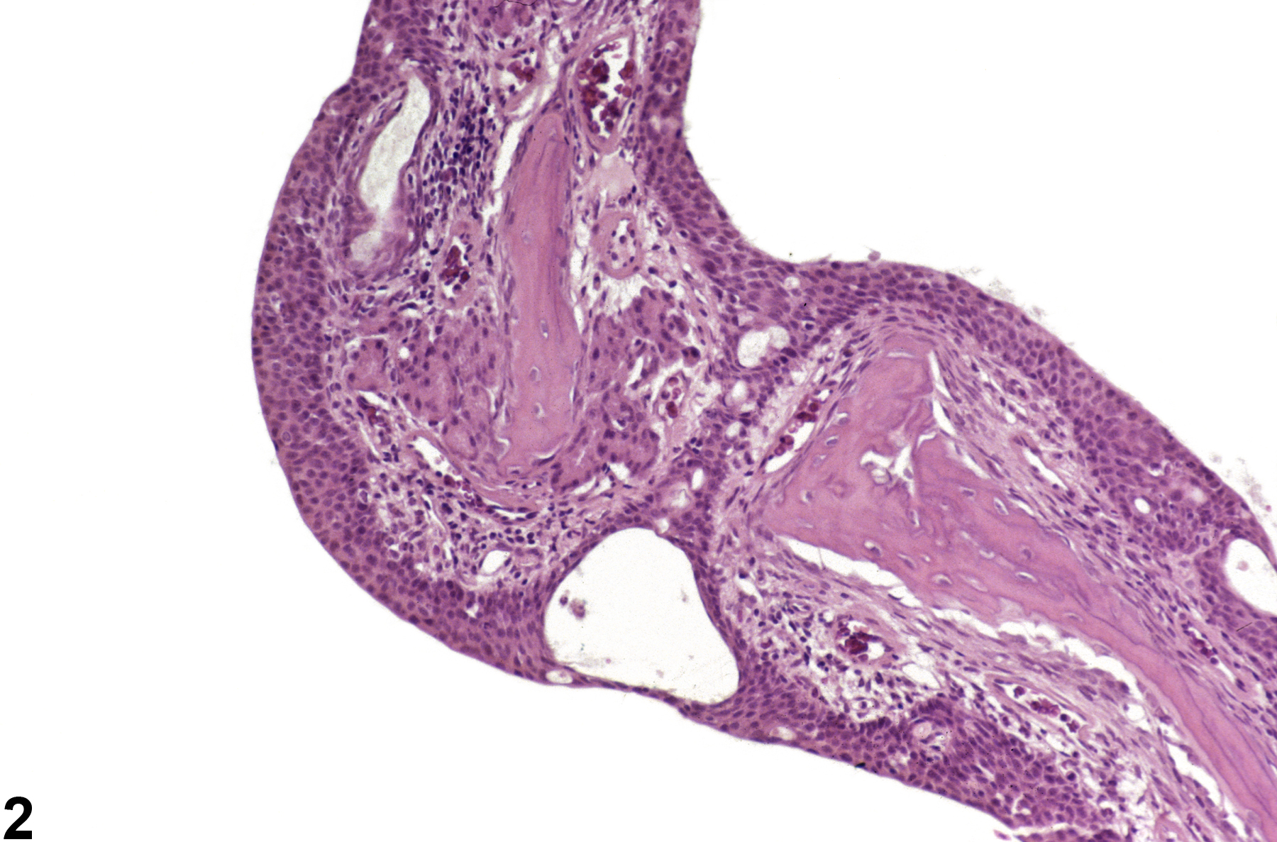 Image of synechia in the nose, turbinate from a male F344/N rat in a subchronic study