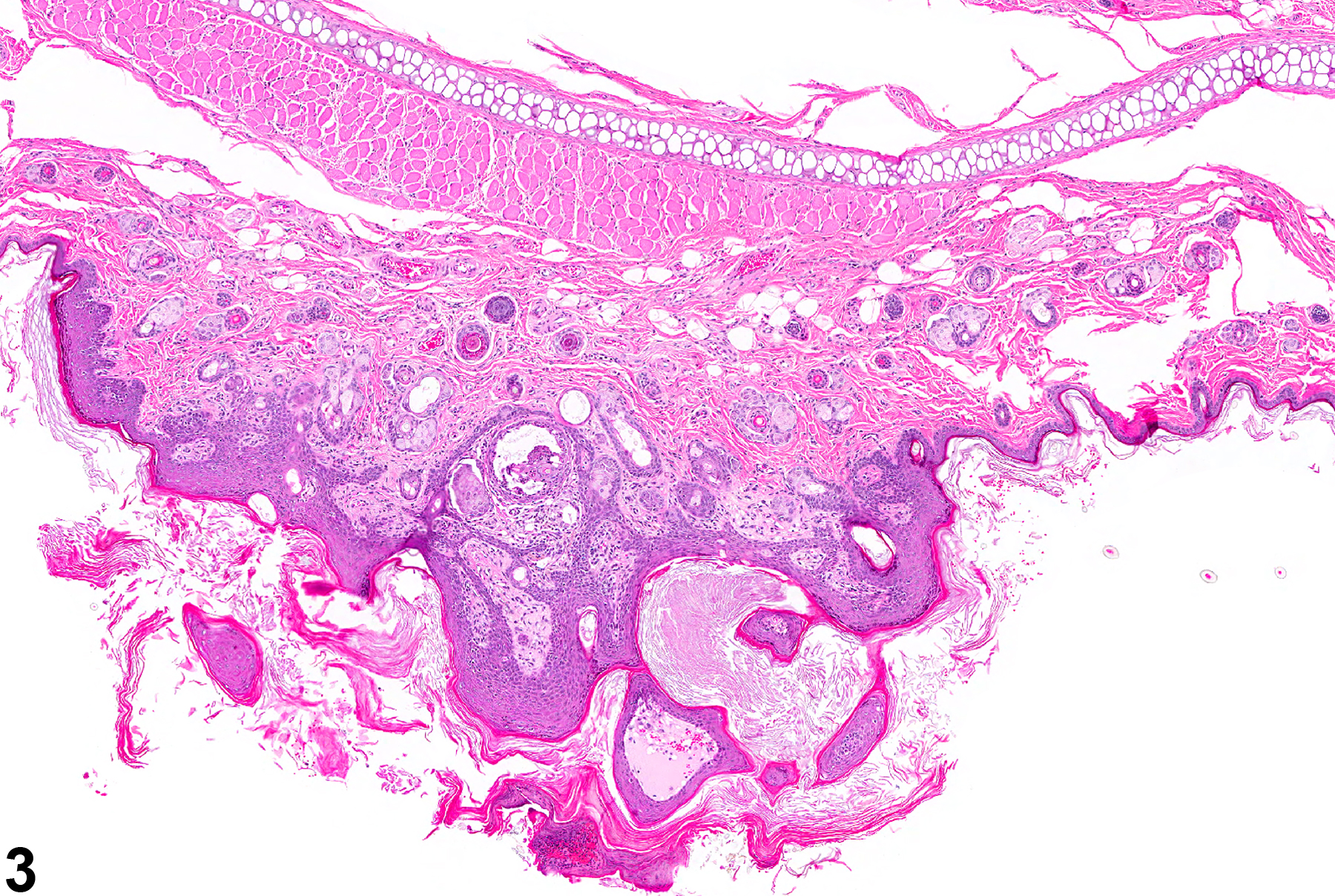 Image of epithelium hyperplasia in the ear from a male F344/N rat in a chronic study