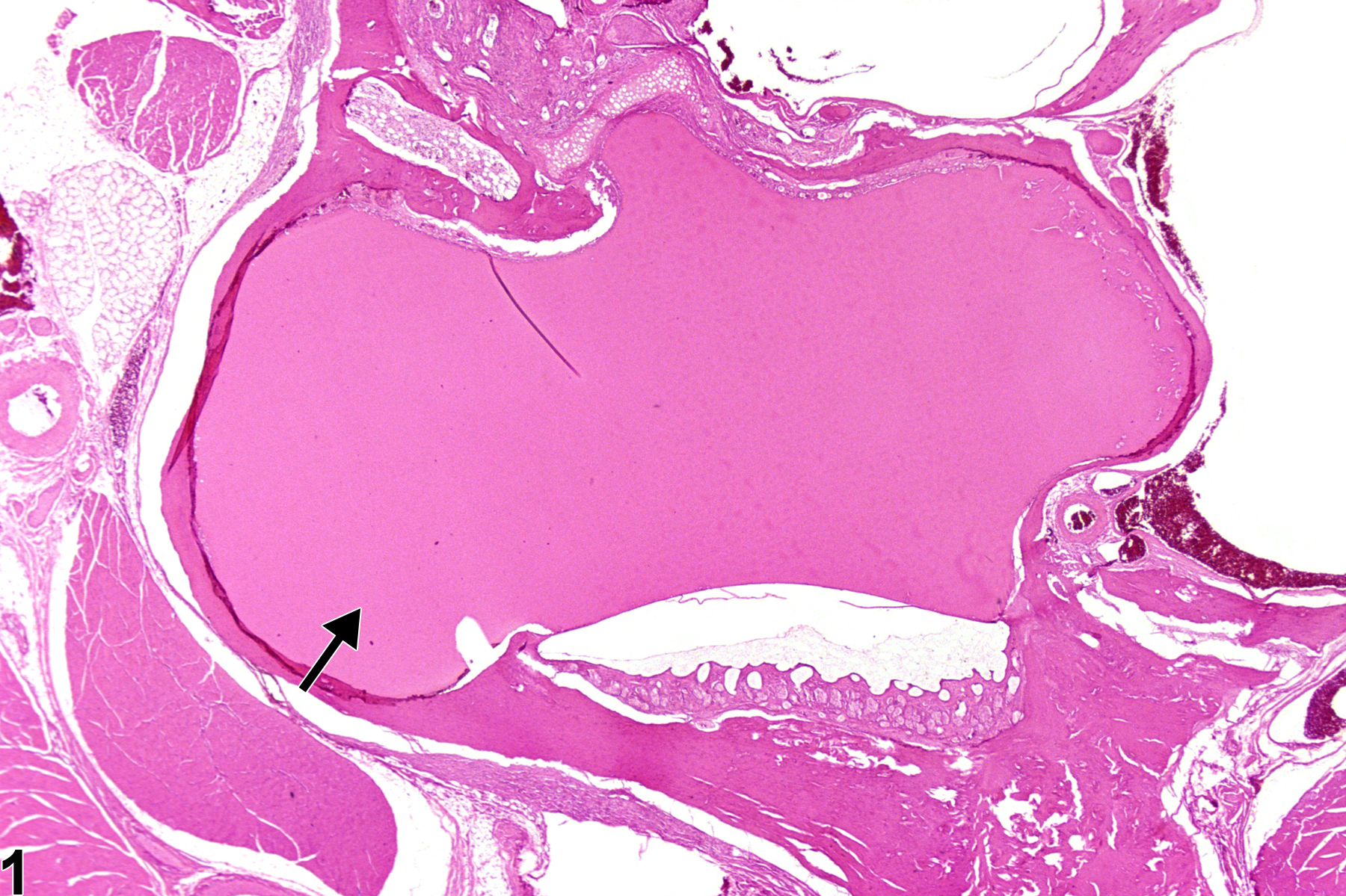 Image of proteinaceous fluid in the ear from a male F344/N rat in a chronic study