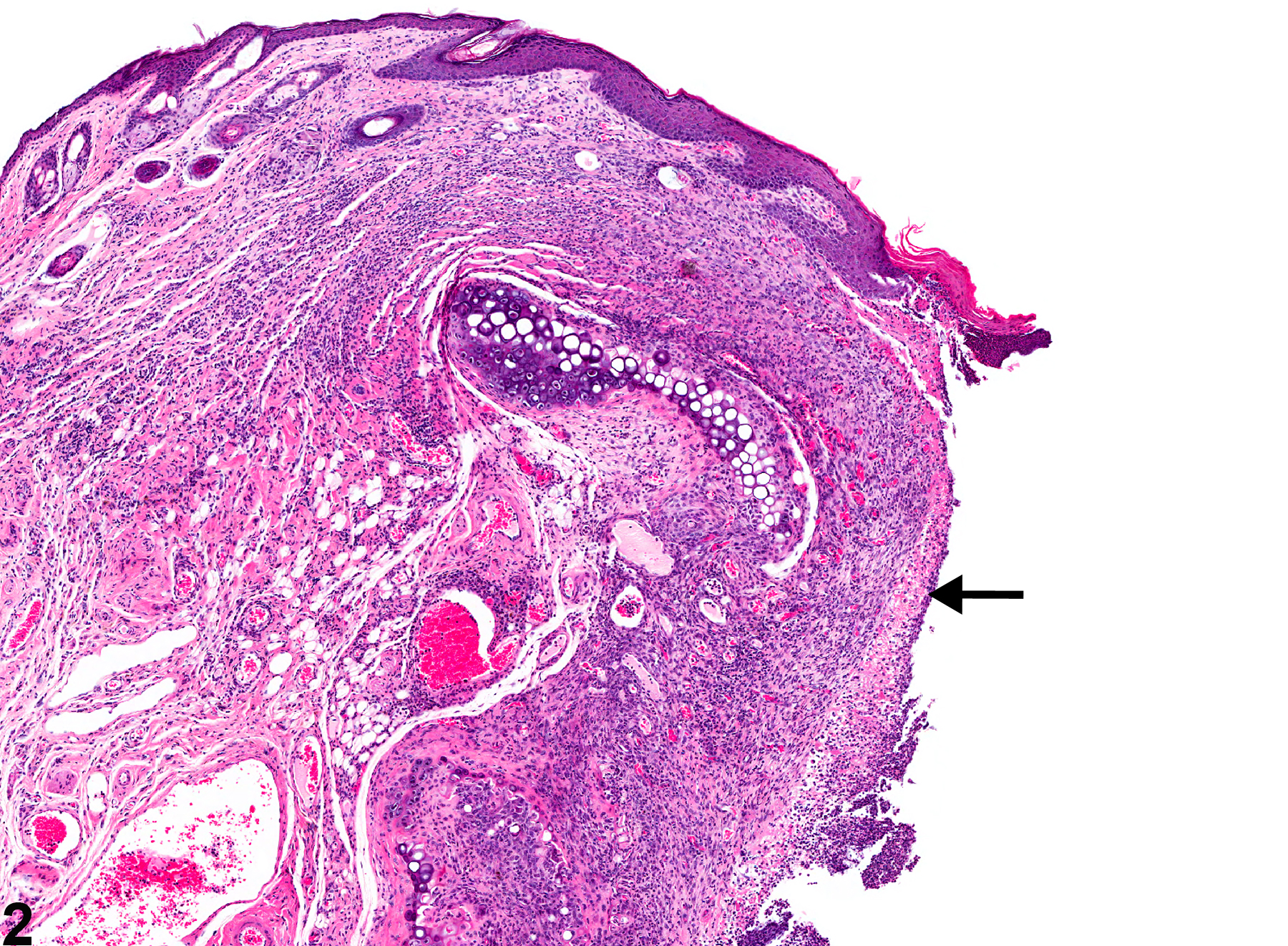 Image of ulcer, erosion in the ear from a male Swiss CD-1 mouse in a chronic study