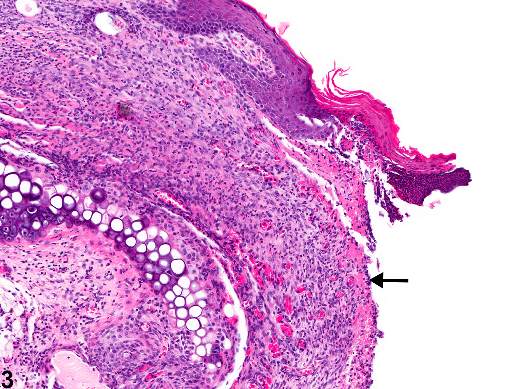 Image of ulcer, erosion in the ear from a male Swiss CD-1 mouse in a chronic study
