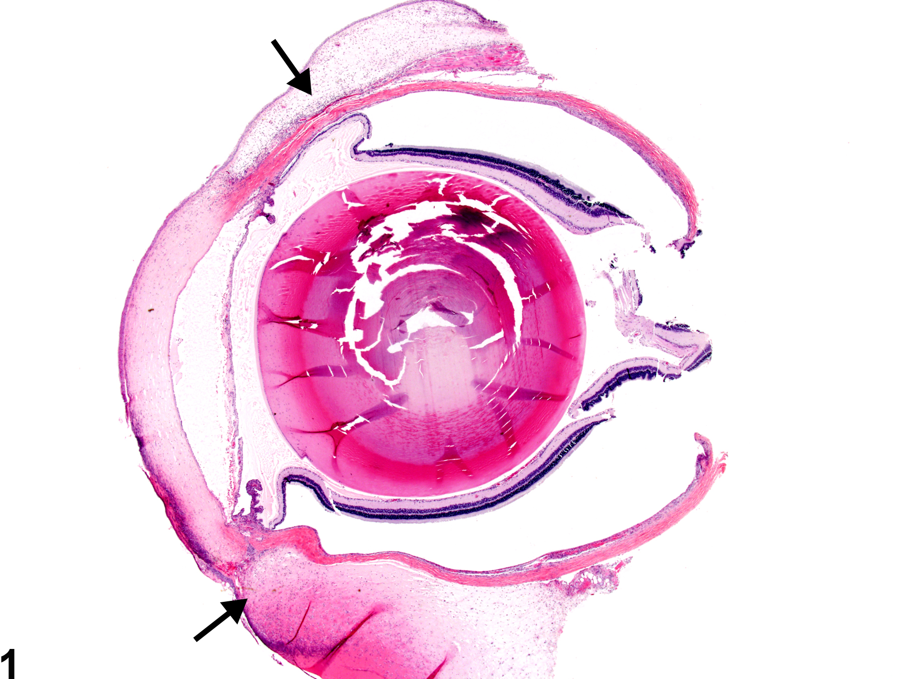 Image of conjunctiva edema in the eye from a female F344/N rat in a chronic study