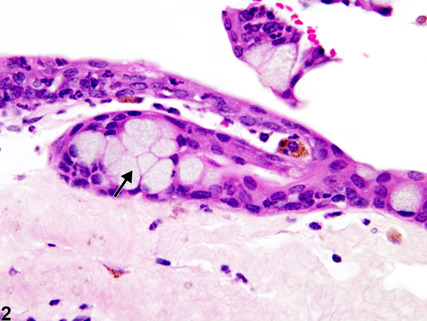 Image of cornea metaplasia, goblet cell in the eye from a female B6C3F1 mouse in a chronic study