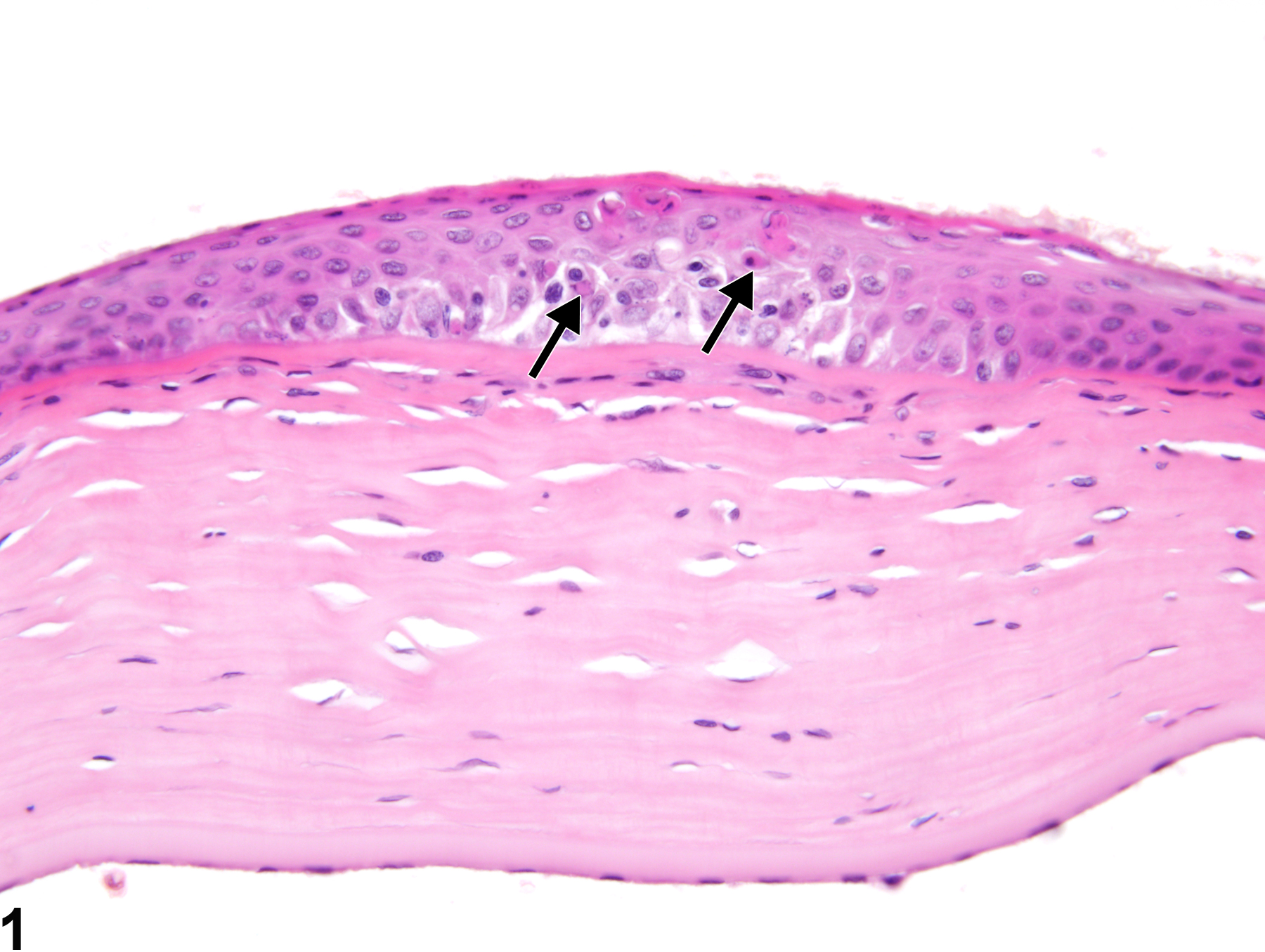 Image of cornea necrosis in the eye from a female F344/N rat in a chronic study