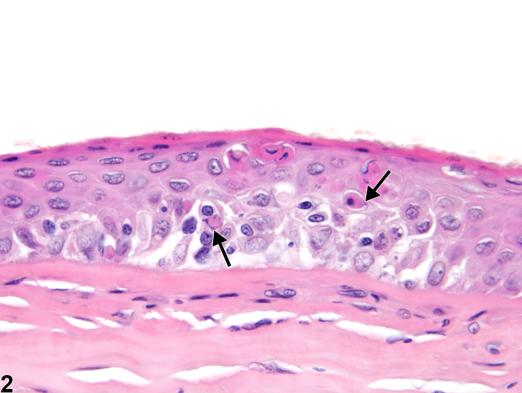 Image of cornea necrosis in the eye from a female F344/N rat in a chronic study