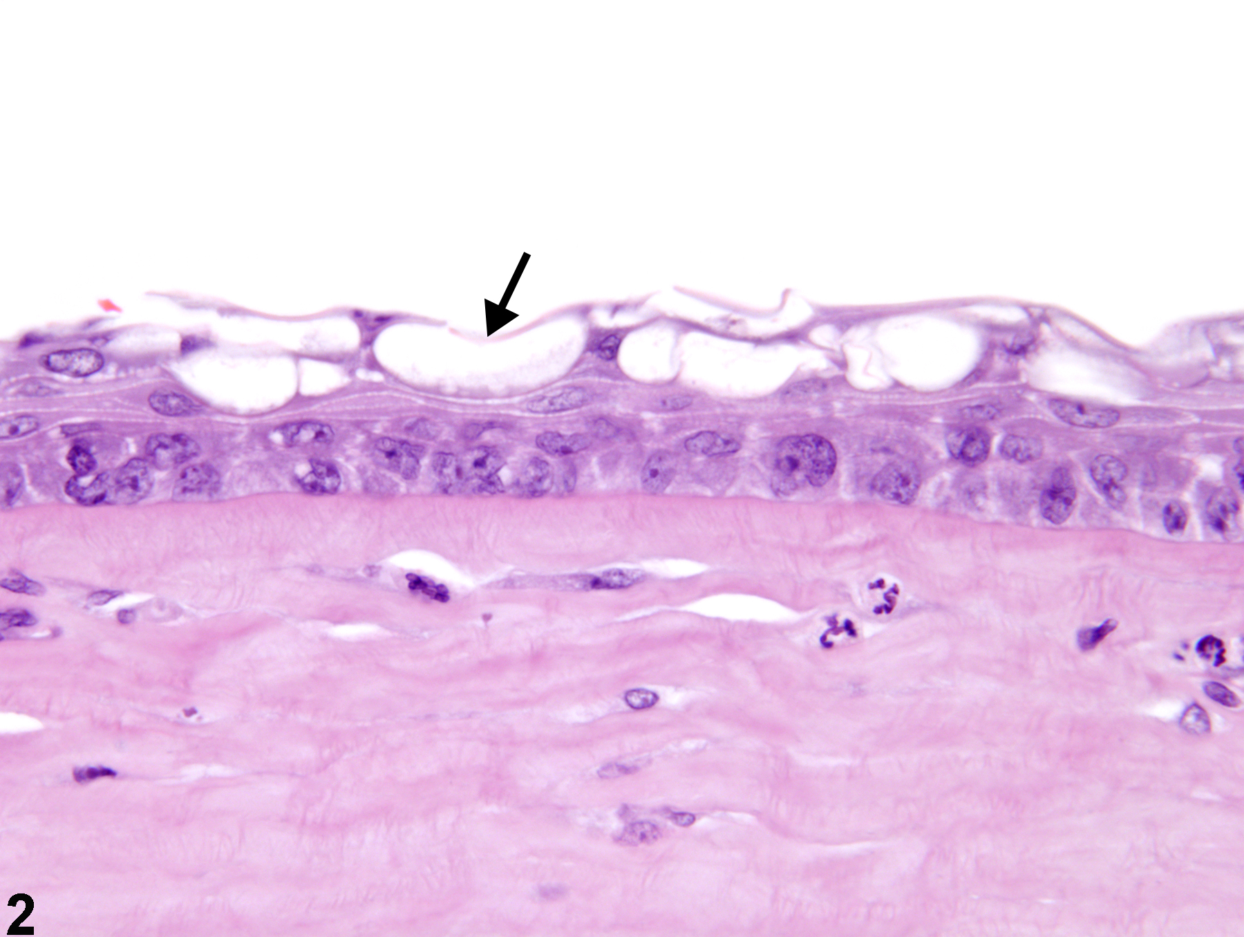 Image of cornea vacuolation, cytoplasmic in the eye from a male F344/N rat in a chronic study