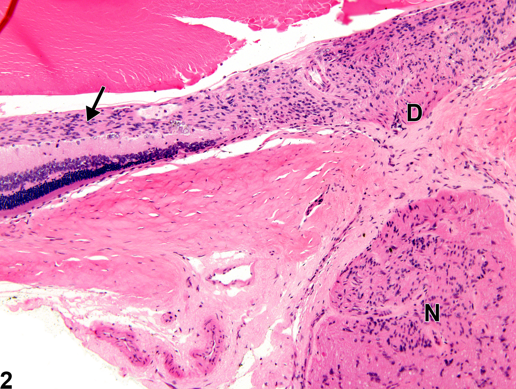 Image of retina gliosis in the eye from a female F344/N rat in a chronic study