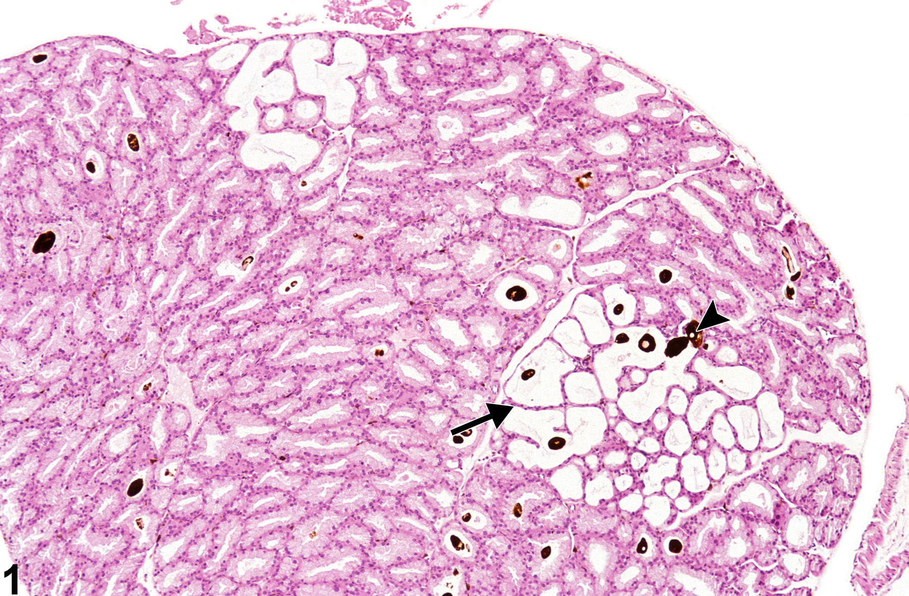 Image of dilation in the Harderian gland from a male B6C3F1 mouse in a chronic study