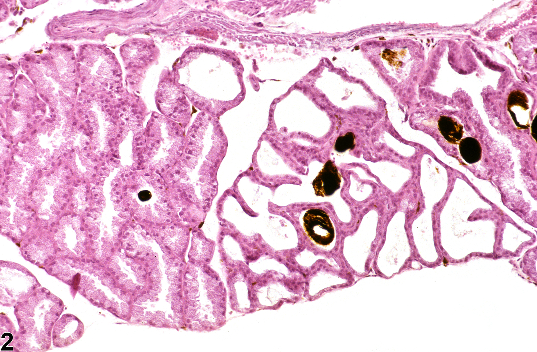 Image of dilation in the Harderian gland from a female B6C3F1 mouse in a chronic study