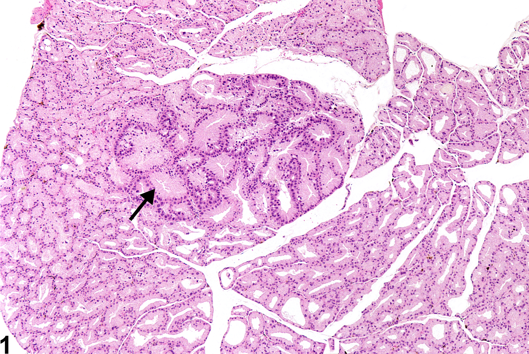 Image of hyperplasia in the Harderian gland from a male B6C3F1 mouse in a chronic study