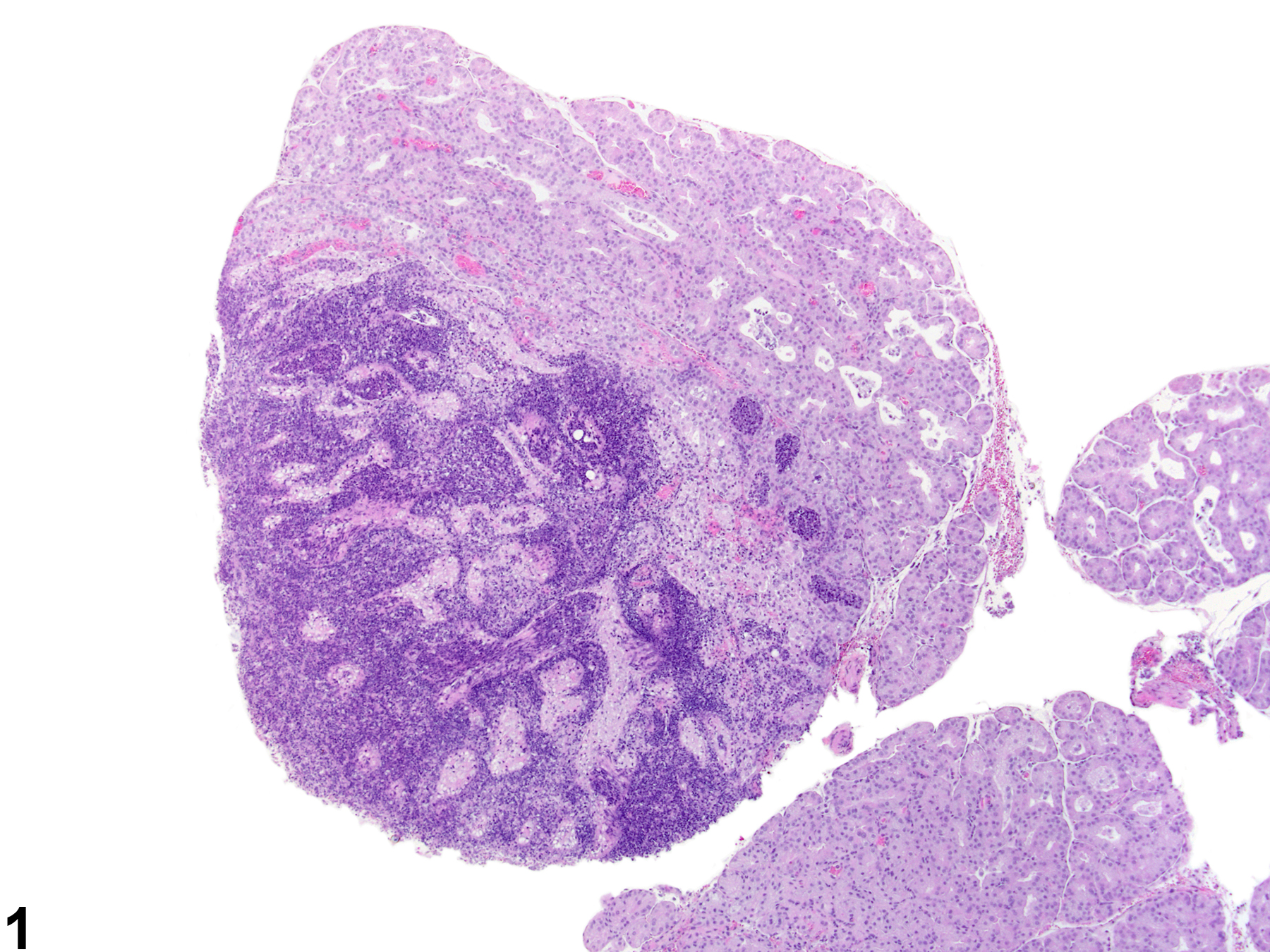Image of inflammation in the Harderian gland from a female Harlan Sprague Dawley rat in a chronic study
