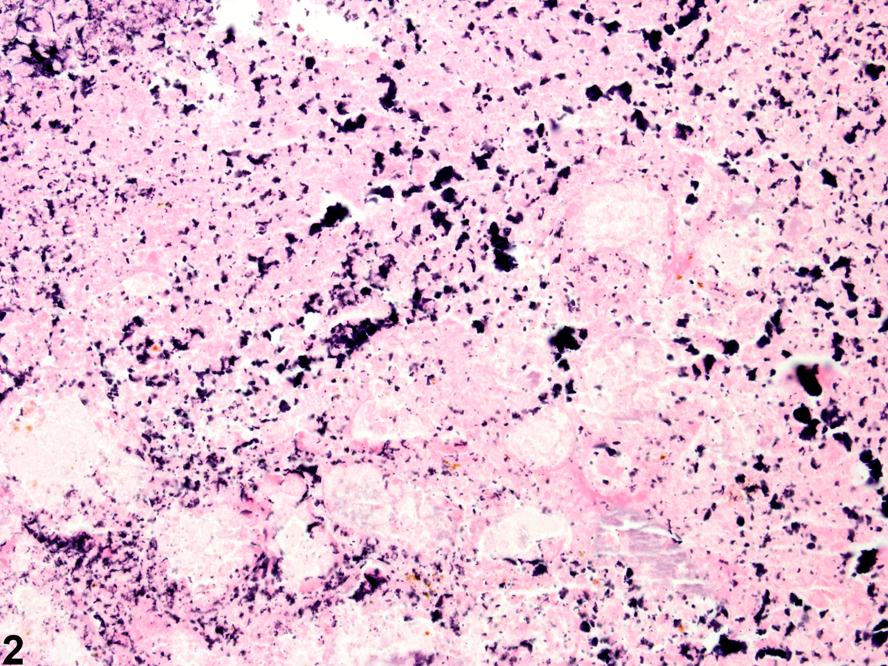 Image of necrosis in the Harderian gland from a male B6C3F1 mouse in a chronic study