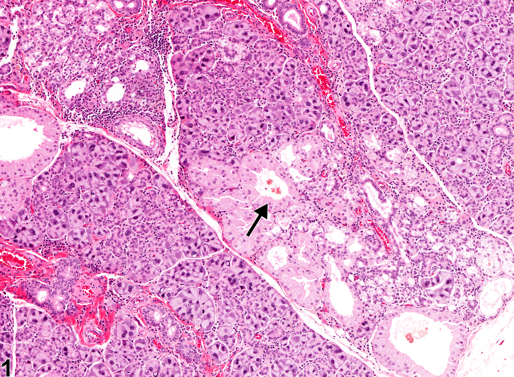 Image of metaplasia, harderian in the lacrimal gland from a male Osborne Mendel rat in a chronic study