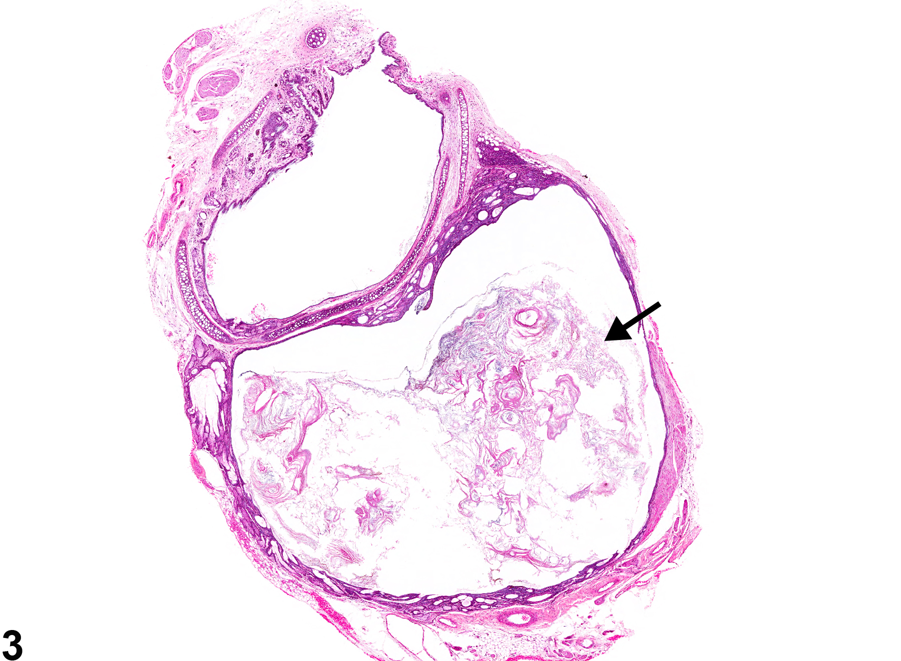 Image of duct cyst in the Zymbal's gland from a male B6C3F1 mouse in a chronic study