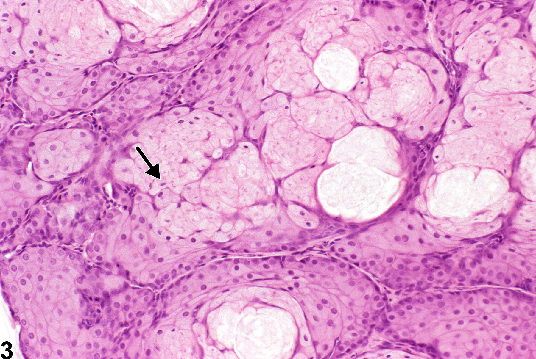 Image of hypertrophy in the Zymbal's gland from a female F344/N rat in a chronic study