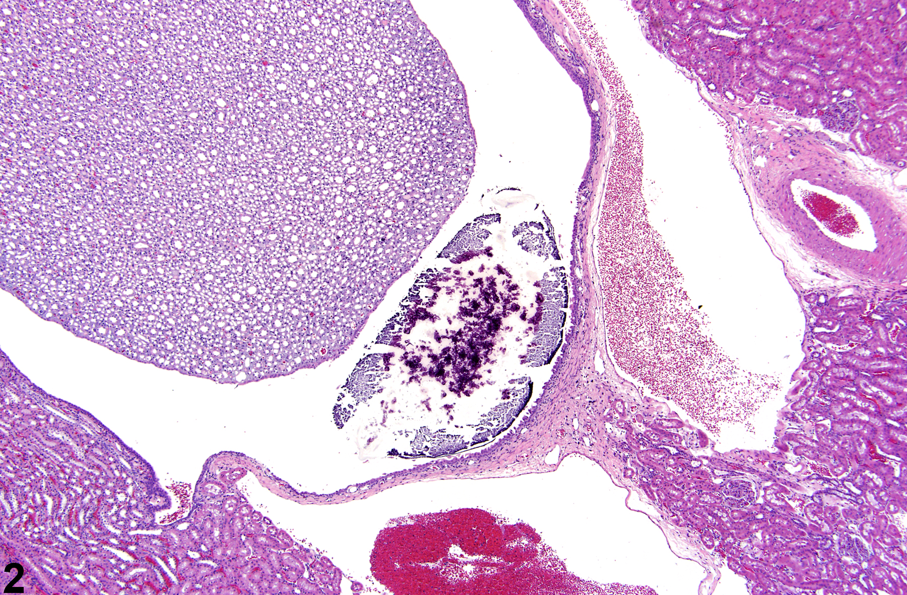 Image of calculus in the kidney from a male Harlan Sprague-Dawley rat in a lifetime study