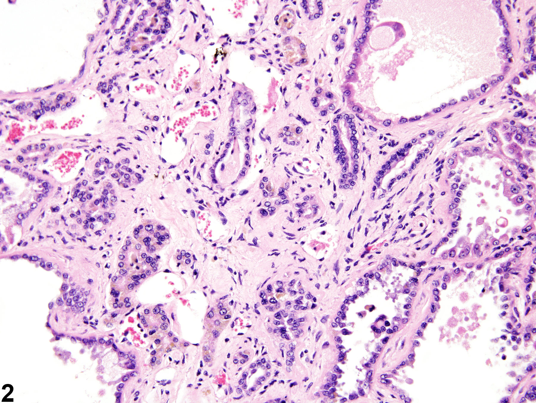 Image of fibrosis in the kidney from a male F344/N rat in a chronic study