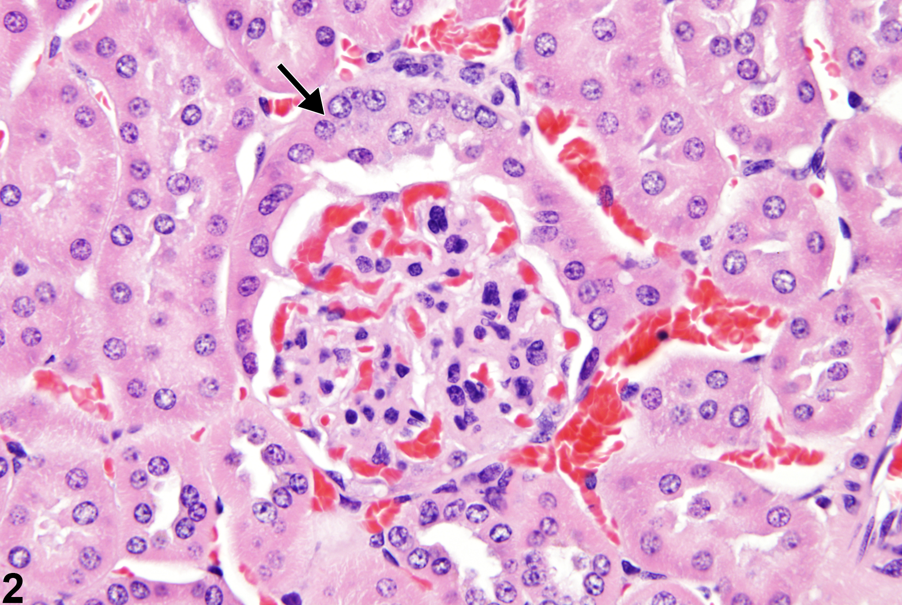 Image of glomerulus metaplasia in the kidney from a female B6C3F1 mouse in a chronic study