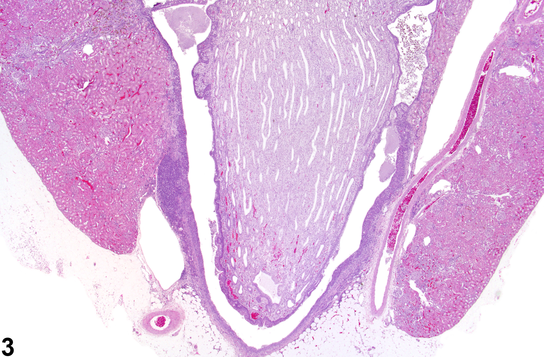 Image of inflammation, chronic in the kidney from a female F344/N rat in a chronic study