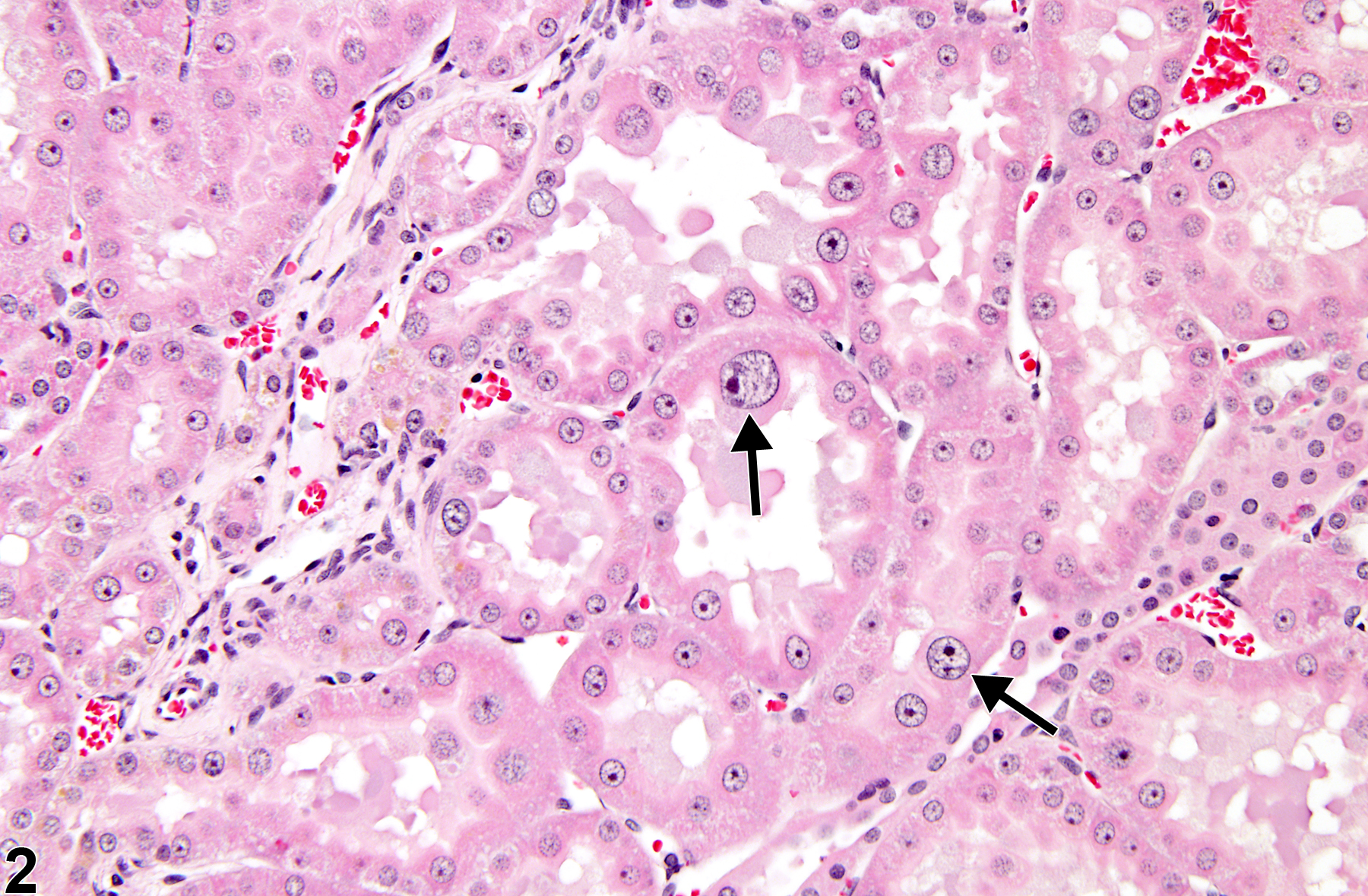 Image of karyomegaly in the kidney from a male F344/N rat in a subchronic study