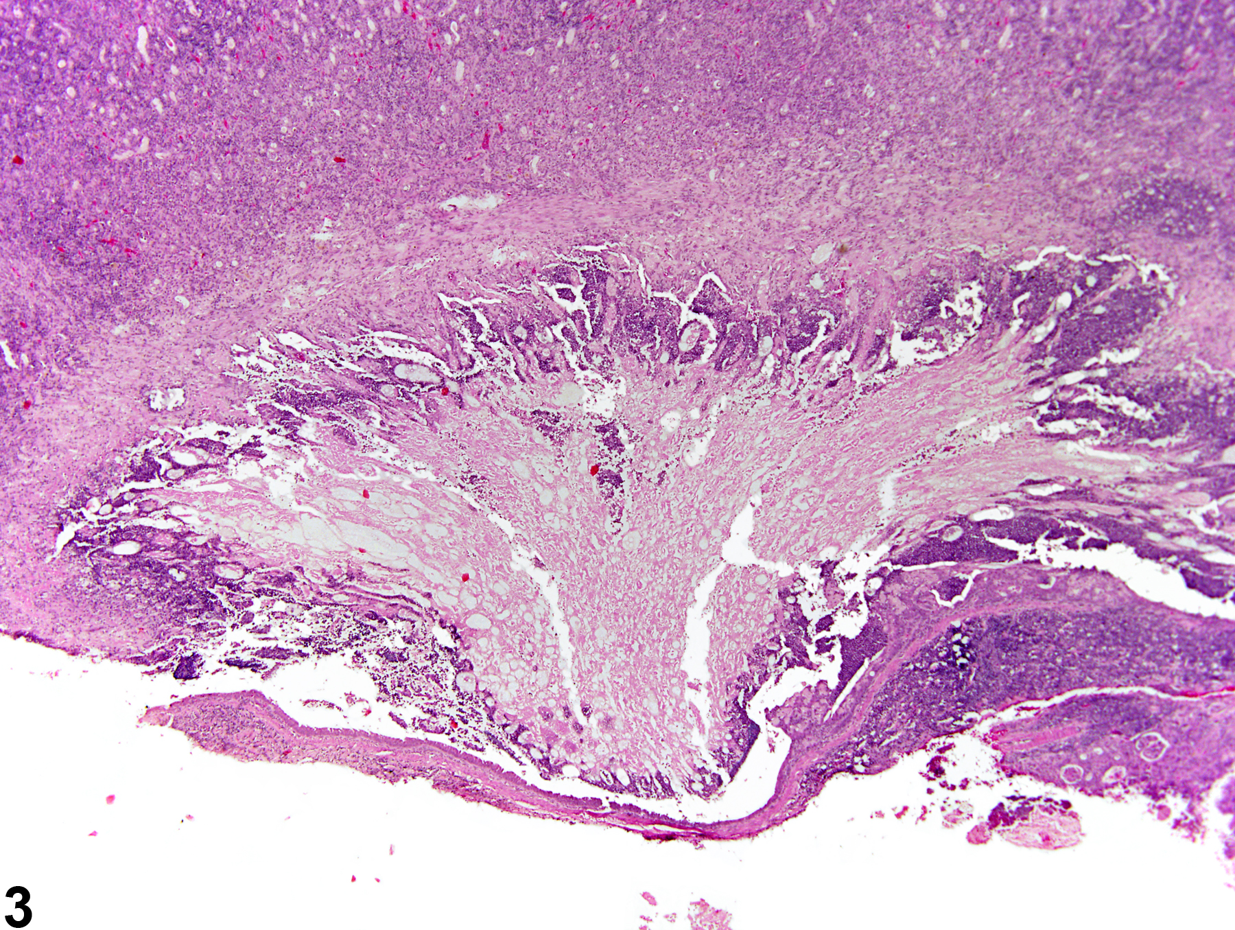 Image of papilla necrosis in the kidney from a female B6C3F1 mouse in a chronic study