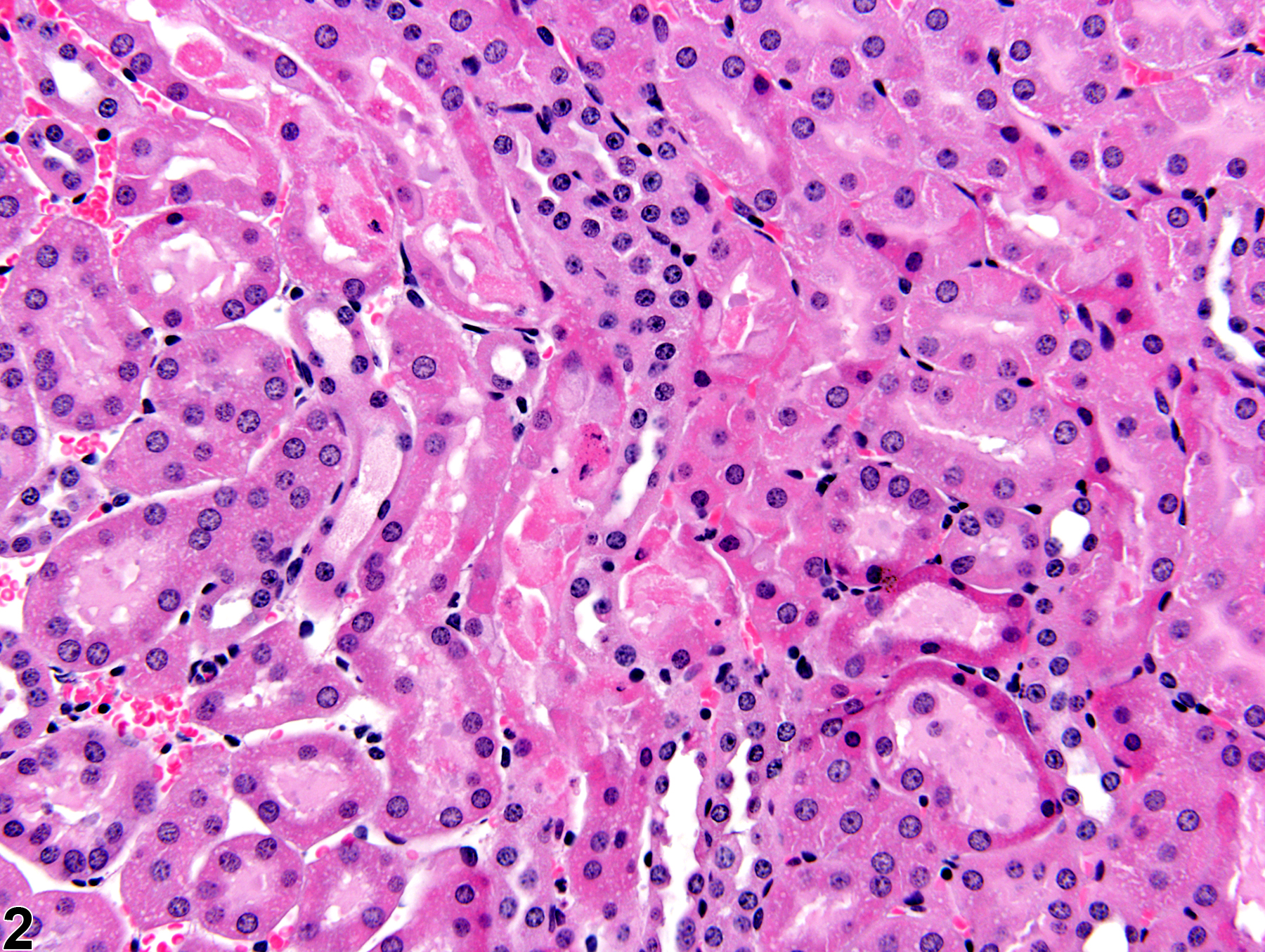 Image of renal tubule necrosis in the kidney from a male B6C3F1 mouse in a subchronic study