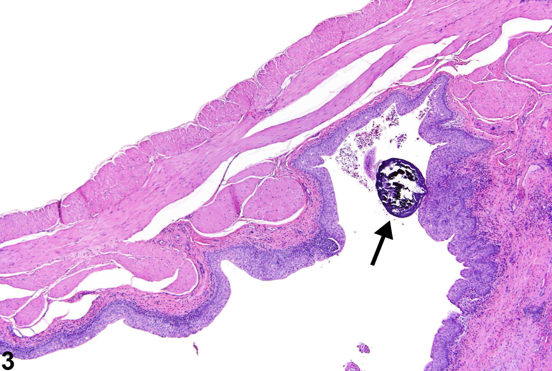 Image of calculus in the urinary bladder from a female Harlan Sprague-Dawley rat in a chronic study