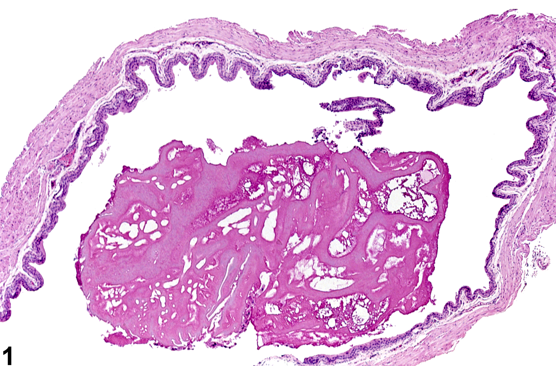 Image of proteinaceous plug in the urinary bladder from a male B6C3F1 mouse in a chronic study