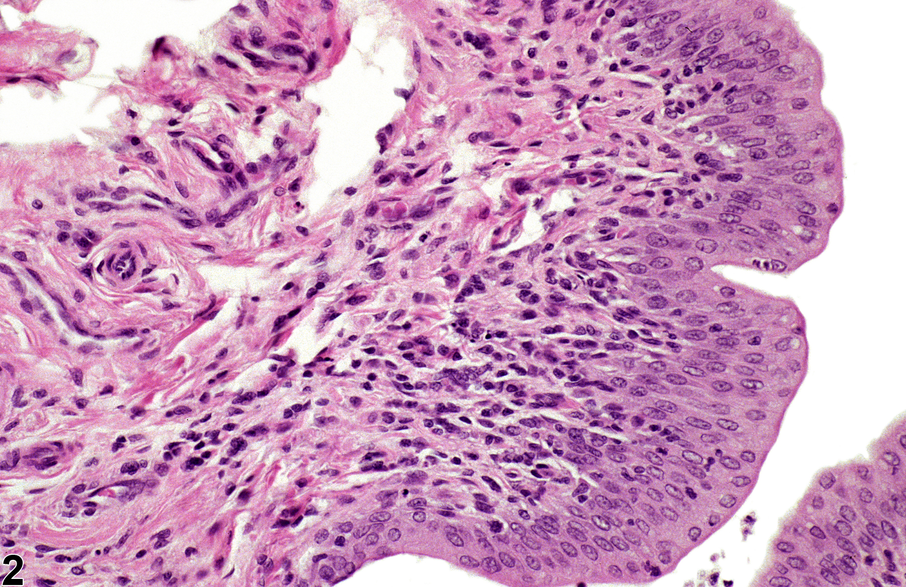 Image of hyperplasia in the urinary bladder from a female Harlan Sprague-Dawley rat in a chronic study
