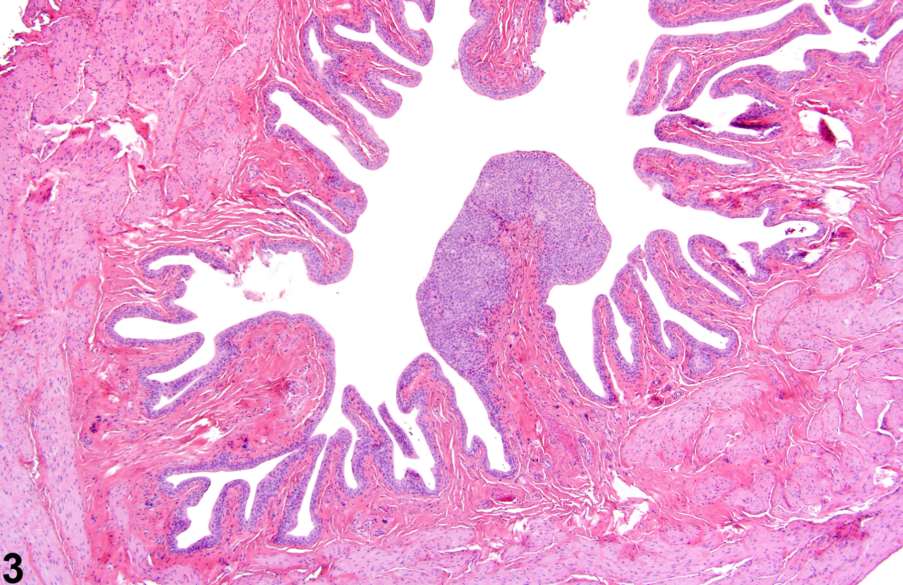 Image of hyperplasia in the urinary bladder from a male F344/N rat in a chronic study