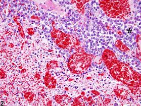 Pituitary Gland Pars Distalis Necrosis Nonneoplastic Lesion Atlas