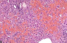 Liver Necrosis Nonneoplastic Lesion Atlas