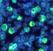 Close-up of Epstein-Barr virus under microscope