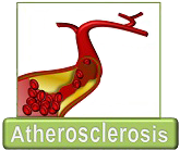 Atherosclerosis