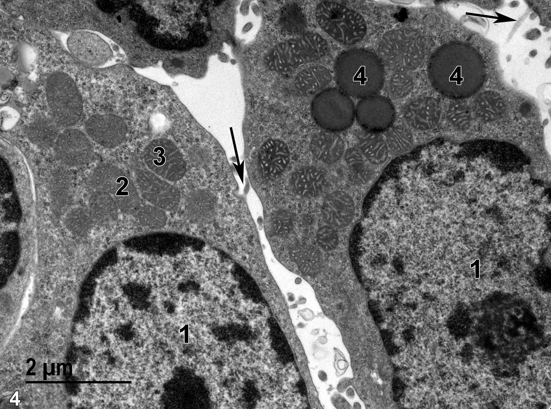 <strong>Figure 4.</strong> A still higher magnification view of zona glomerulosa epithelial cells showing nuclei (1) with prominent nucleoli and marginated heterochromatin, mitochondria with vesicular cristae (2) when cut in cross section, and tubular cristae (3) when cut in a more longitudinal section. Lipid droplets (4) are relatively electron dense. The surface of the epithelial cells have microvilli (arrows) protruding into the intercellular spaces. Clusters of dark particles are found throughout the cytoplasm, which are particulate glycogen and free ribosomes. 13000x.