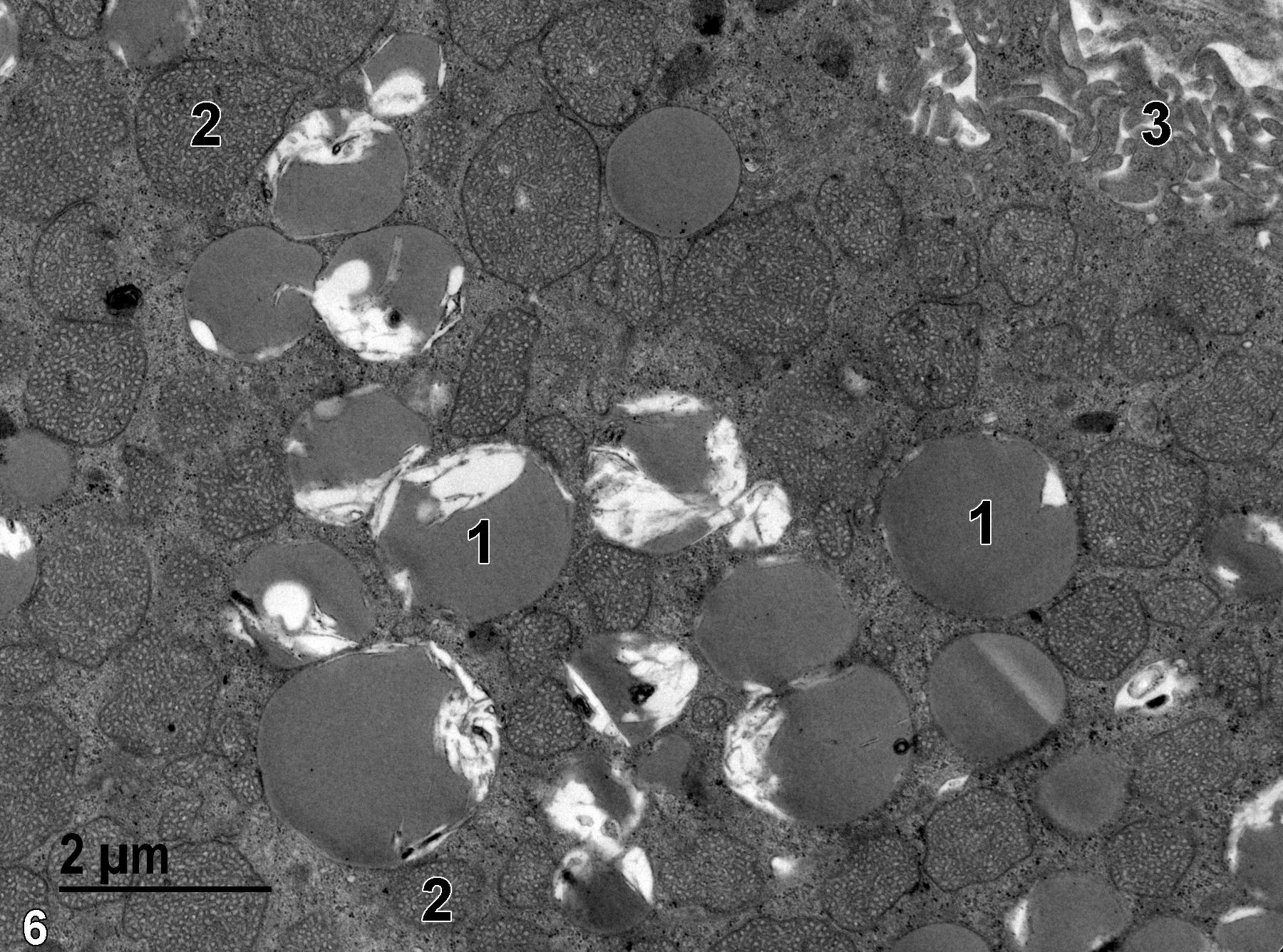 <strong>Figure 6.</strong> A higher magnification view of the content of a zona fasciculata cell. The cell is densely packed with mitochondria (2) and lipid droplets (1), some of which have homogeneous electron-dense contents, and others with variable amounts of membranous profiles. The microvilli (3) at the surface of the cell are numerous in this view. 11000x.